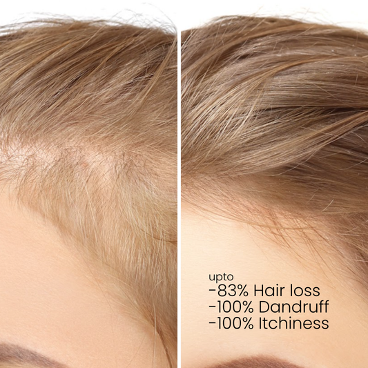 Celebrazione dei capelli